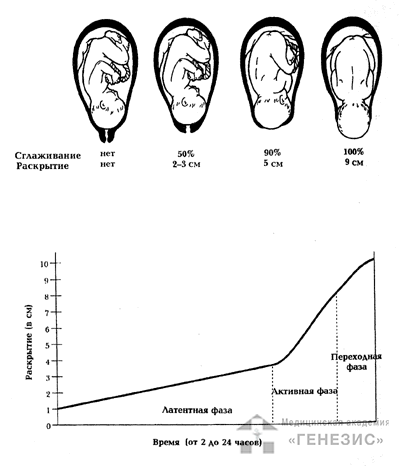 Латентная фаза родов. Латентная и активная фаза родов. Активная фаза родов. Латентная и активная фаза первого периода родов.