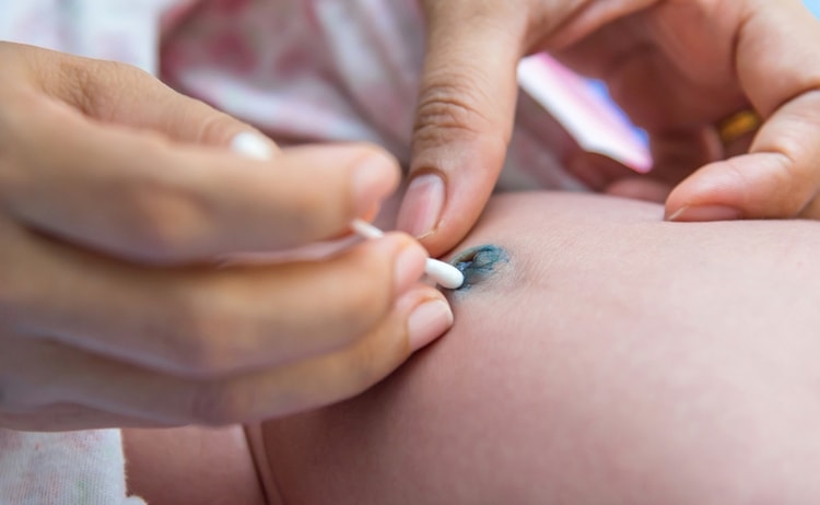 Узнайте, как обрабатывать пупок новорожденного после отпадения прищепки.