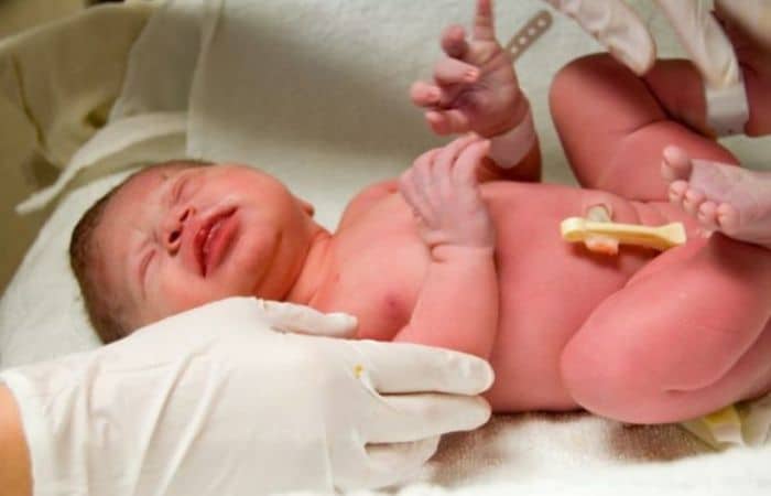 шкала апгар расшифровка 