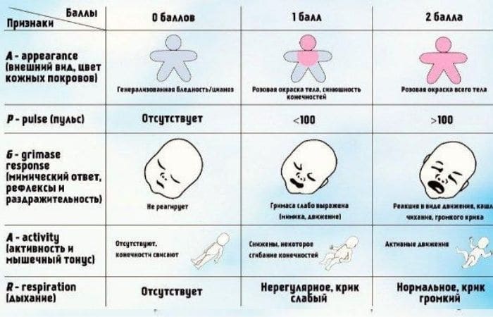 что такое шкала апгар для новорожденных 