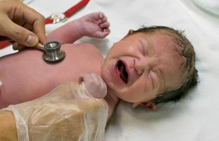 тест новорожденных по шкале апгар 